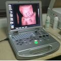 медицинское оборудование ультразвука doppler &amp; Б УЗИ сканер